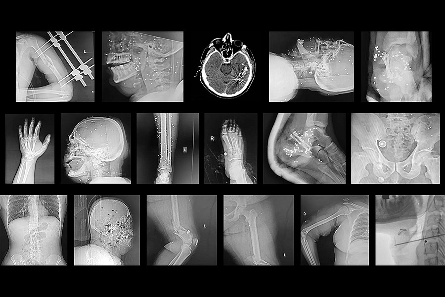 حتی بیمارستان‌ها هم در ایران امن نیستند/ گزارش تکان‌دهنده نیویورکر از یورش نیروهای امنیتی به مجروحان اعتراضات دی ۱۴۰۴