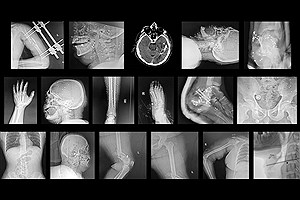 حتی بیمارستان‌ها هم در ایران امن نیستند/ گزارش تکان‌دهنده نیویورکر از یورش نیروهای امنیتی به مجروحان اعتراضات دی ۱۴۰۴